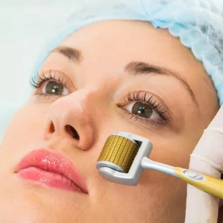 ZGTS Derma Roller Professional Gold Titanium